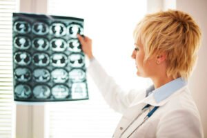 Imposto de renda para Neurologistas Neurologista: Carnê-Leão e Declaração de IR são a mesma coisa ?